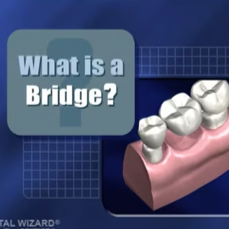 What is a Bridge?